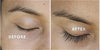 Bimataprost Eyelash Growth Serum